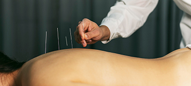 A-woman-lays-down-receiving-acupuncture