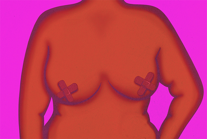 An upper torso with bandages covering scabs on the nipples. 