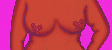 An upper torso with bandages covering scabs on the nipples. 
