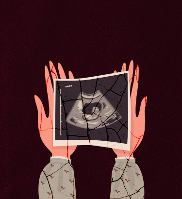 Open-hands-holding-ultrasound-picture