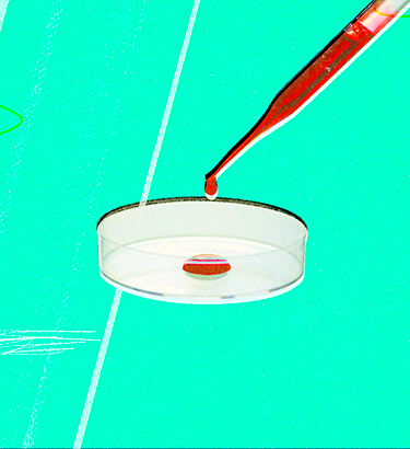A dropper puts a blood sample into a petri dish against a bright sea foam green background.