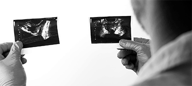 A doctor looks at an x-ray of a prostate.