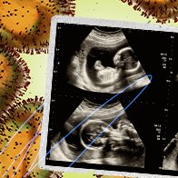 An ultrasound of a baby is laying on top of orange monkeypox virus cells.