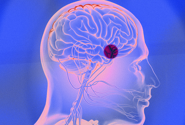 A pink x-tray of a brain has a red dot over the pituitary gland with a blueish background.
