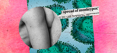 Two bodies against each other are collaged with the monkeypox virus and a news clipping about it.