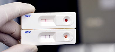 A positive test for Hepatitis C is held up together with a negative test.