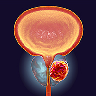 A male prostate glows in orange against a dark blue background.