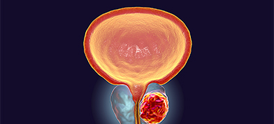 A male prostate glows in orange against a dark blue background.