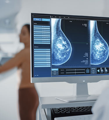 A doctor looks at a screen that shows a woman's mammogram who is standing in the background.
