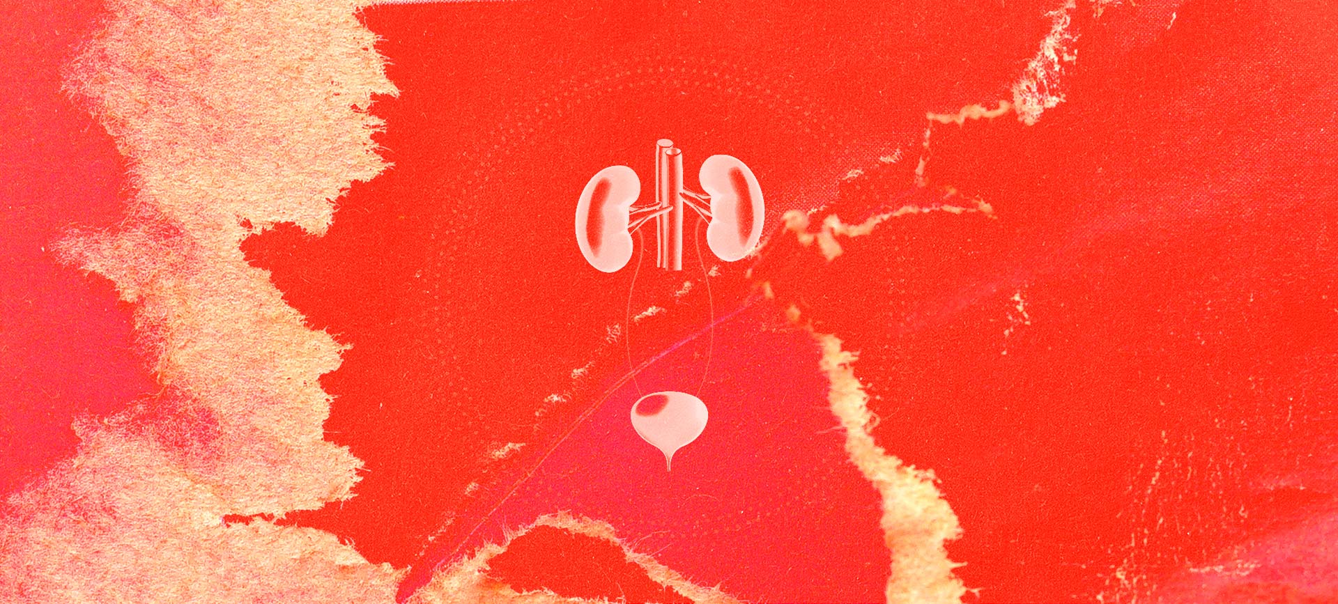 Two kidneys and a bladder are against a red and yellow background.