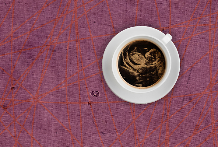 A white mug of coffee sits on a purple and red lined table and shows a fetal ultrasound in the foam. 
