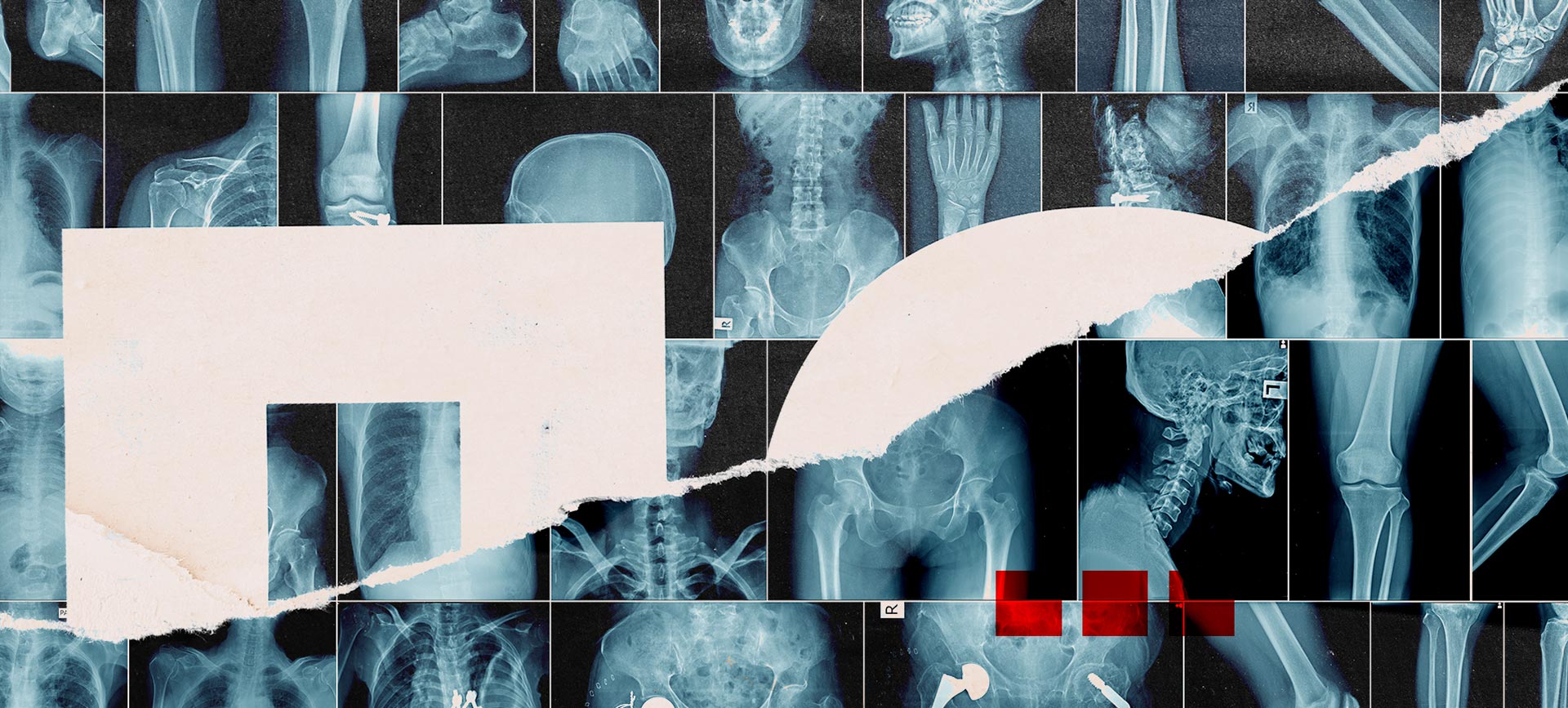 Multiple side by side x-rays of different body parts have some white shreds of paper over top.