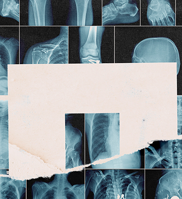 Multiple side by side x-rays of different body parts have some white shreds of paper over top.