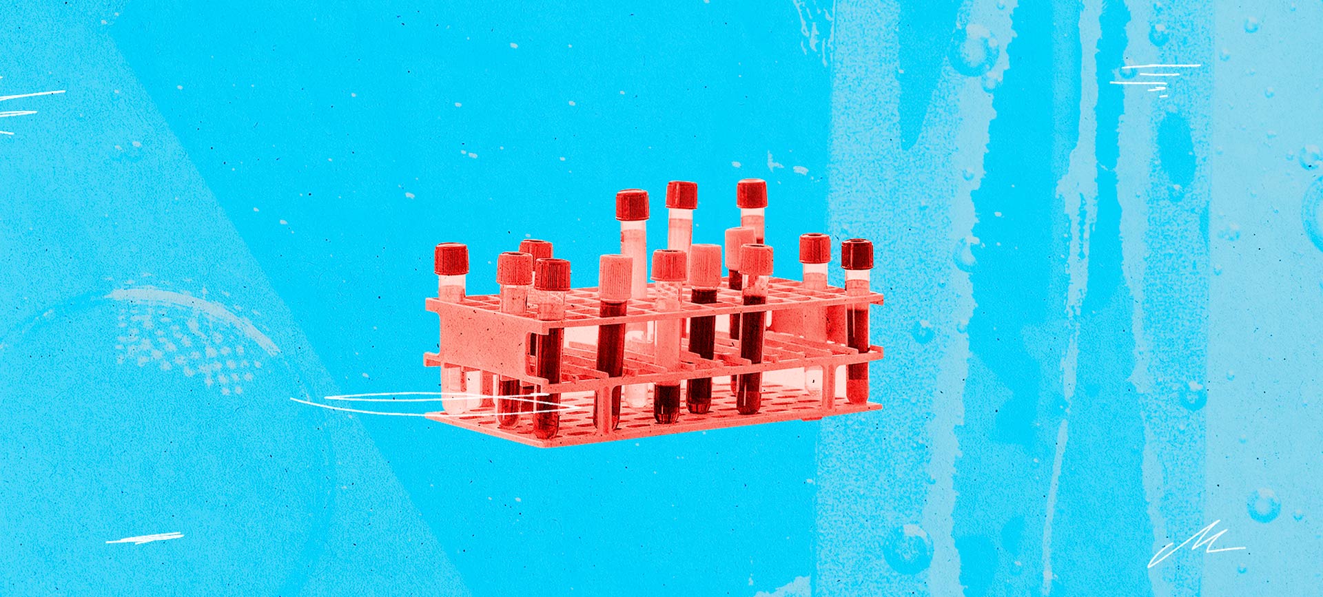 A tray of test tubes with blood in them sit against a light blue background.
