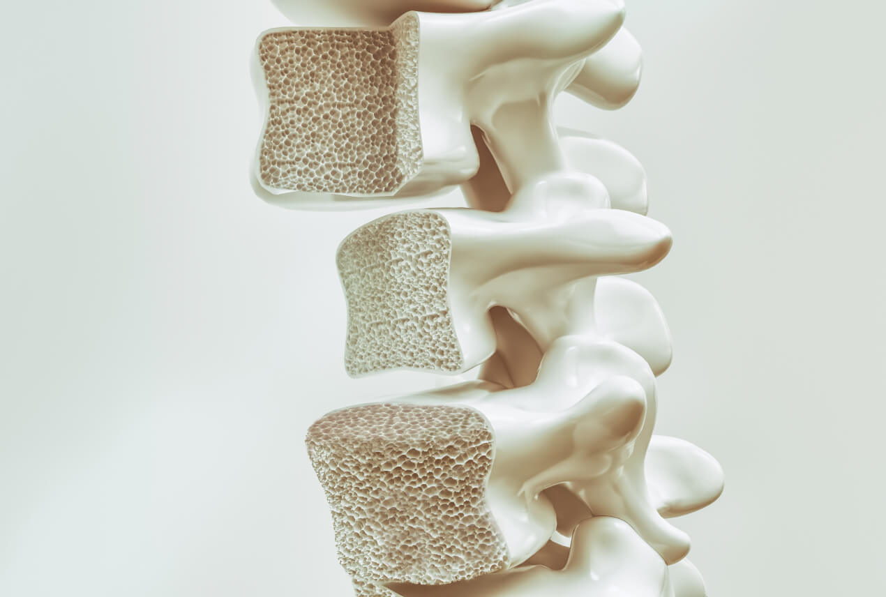 Cross-sections of bone models show the small holes inside.