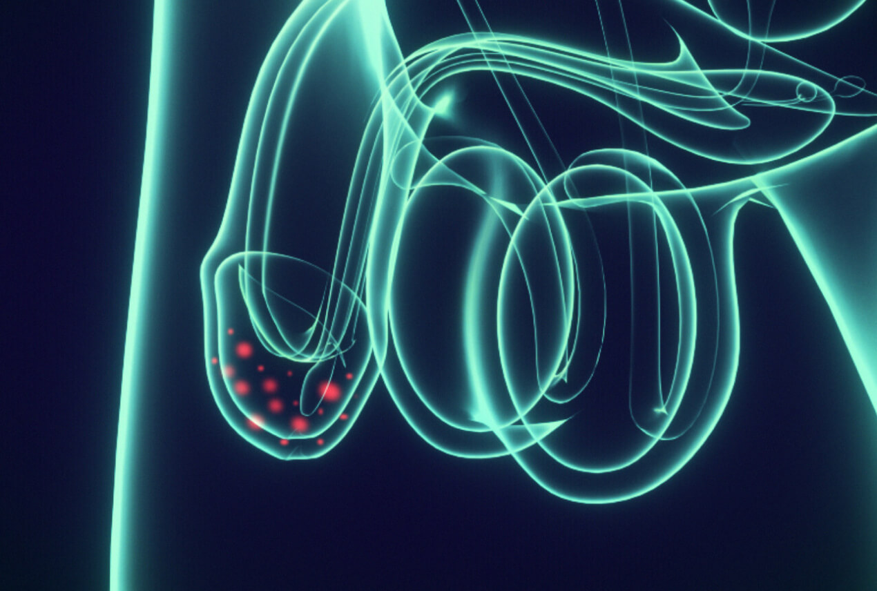 A neon outline of the male reproductive system highlights the head of the penis with red, glowing dots.