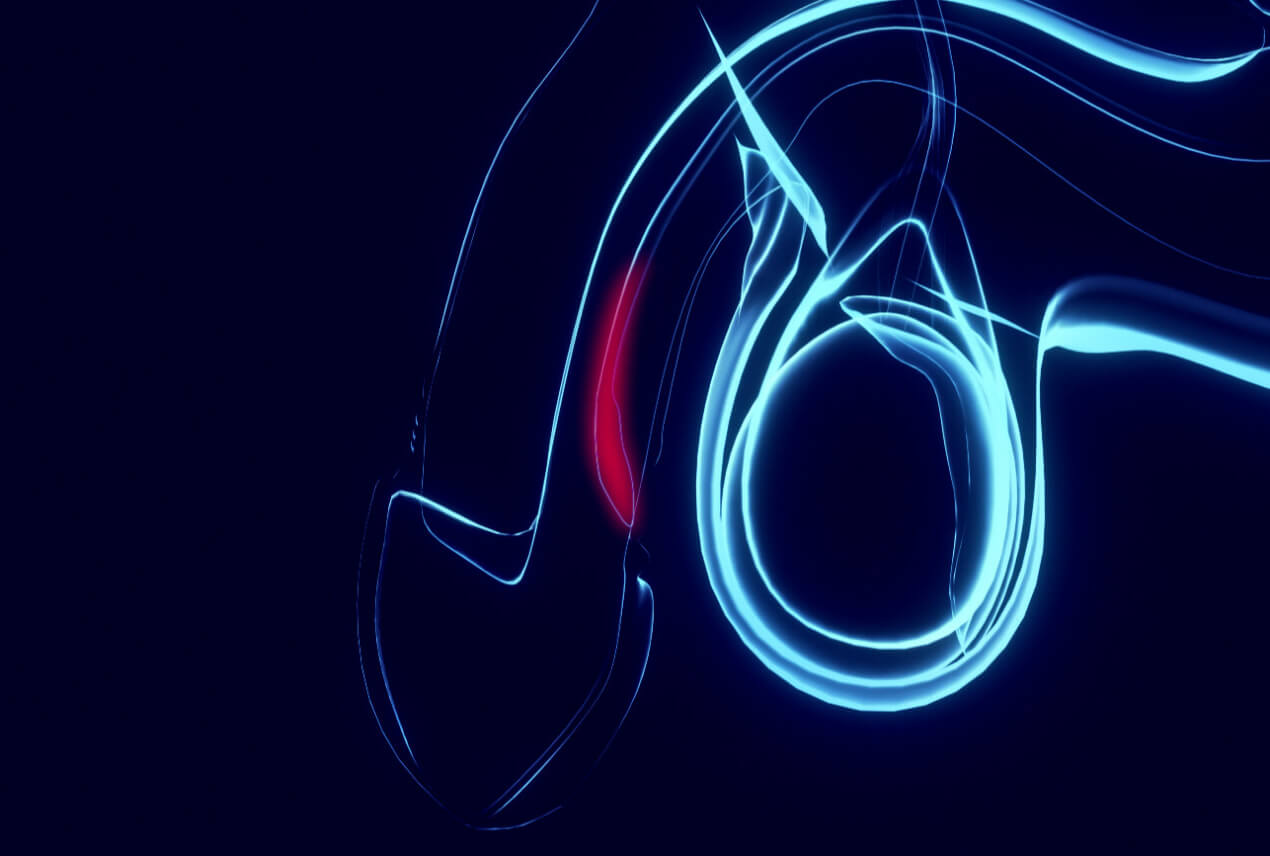 A blue outline of a penis and testicles highlights a downward-tilting-urethra with red.
