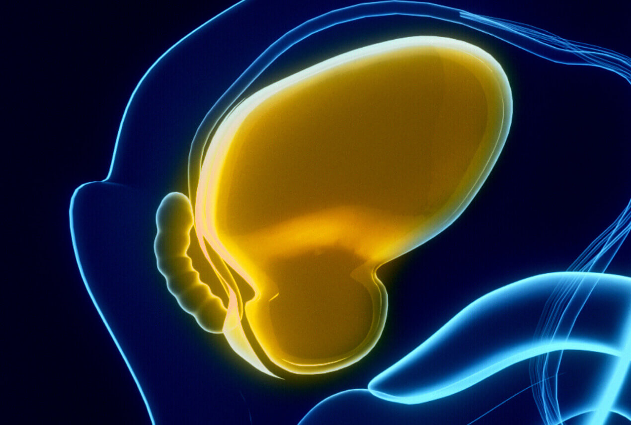 A diagram of a bladder and a urinary tract.
