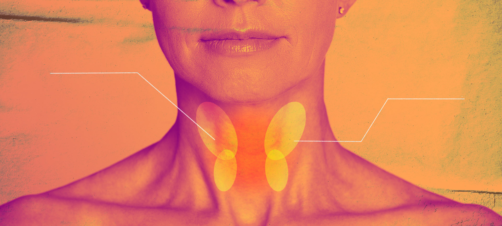 Two yellow ovals highlight each side of the thyroid on the outside of the neck.