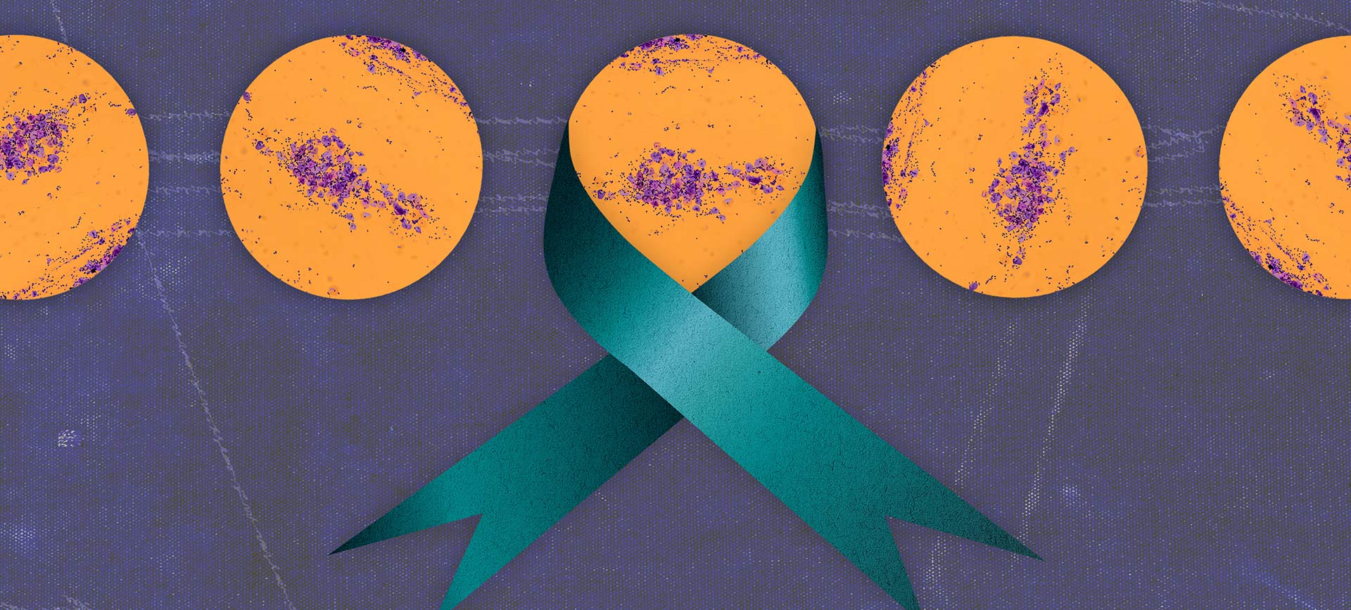Five orange petri dishes with cell samples line in a row with a teal ribbon around the middle one.