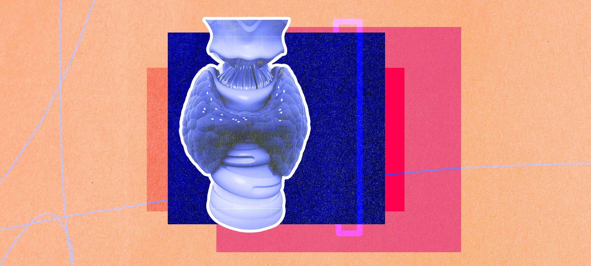 Various shades of blue and pink boxes are behind a blue thyroid against an orange background.