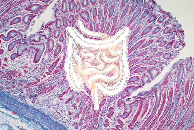 A pink intestine is against a pinkish purple cancer cell.