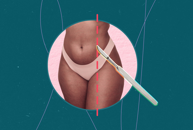 woman's pelvic region with a scalpel cutting a red dashed line down one side 