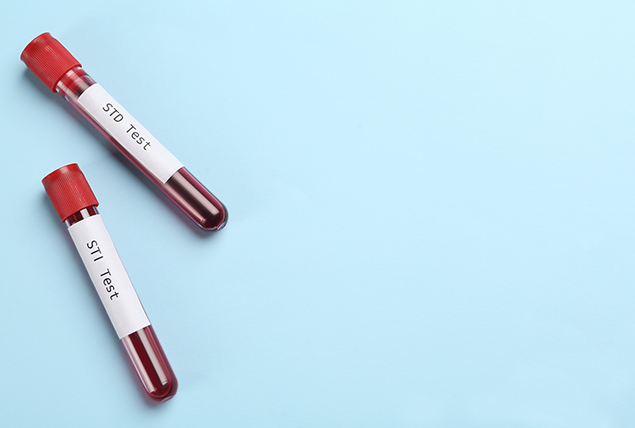 Two vials of blood sit against a light blue surface.