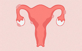A pink female reproductive system has clumps of cells growing on the outside.